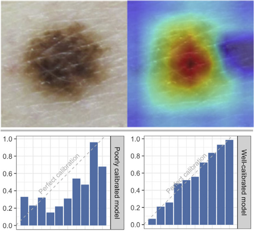 Artificial Intelligence in Dermatology: A Primer