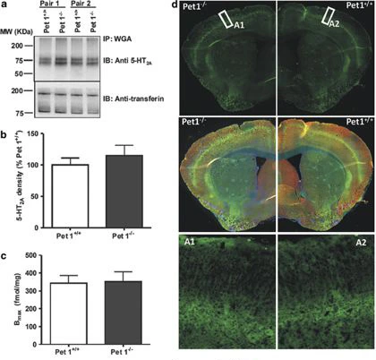 The presynaptic component of the serotonergic system is required for clozapine's efficacy