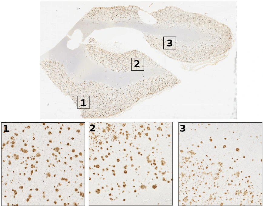 Validation of machine learning models to detect amyloid pathologies across institutions