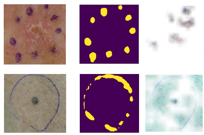 Global Saliency: Aggregating Saliency Maps to Assess Dataset Artefact Bias