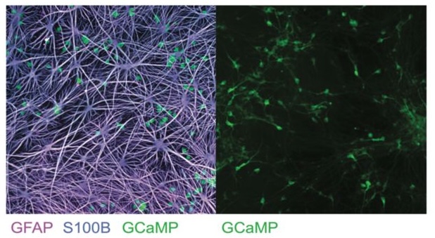 Network-aware self-supervised learning enables high-content phenotypic screening for genetic modifiers of neuronal activity dynamics