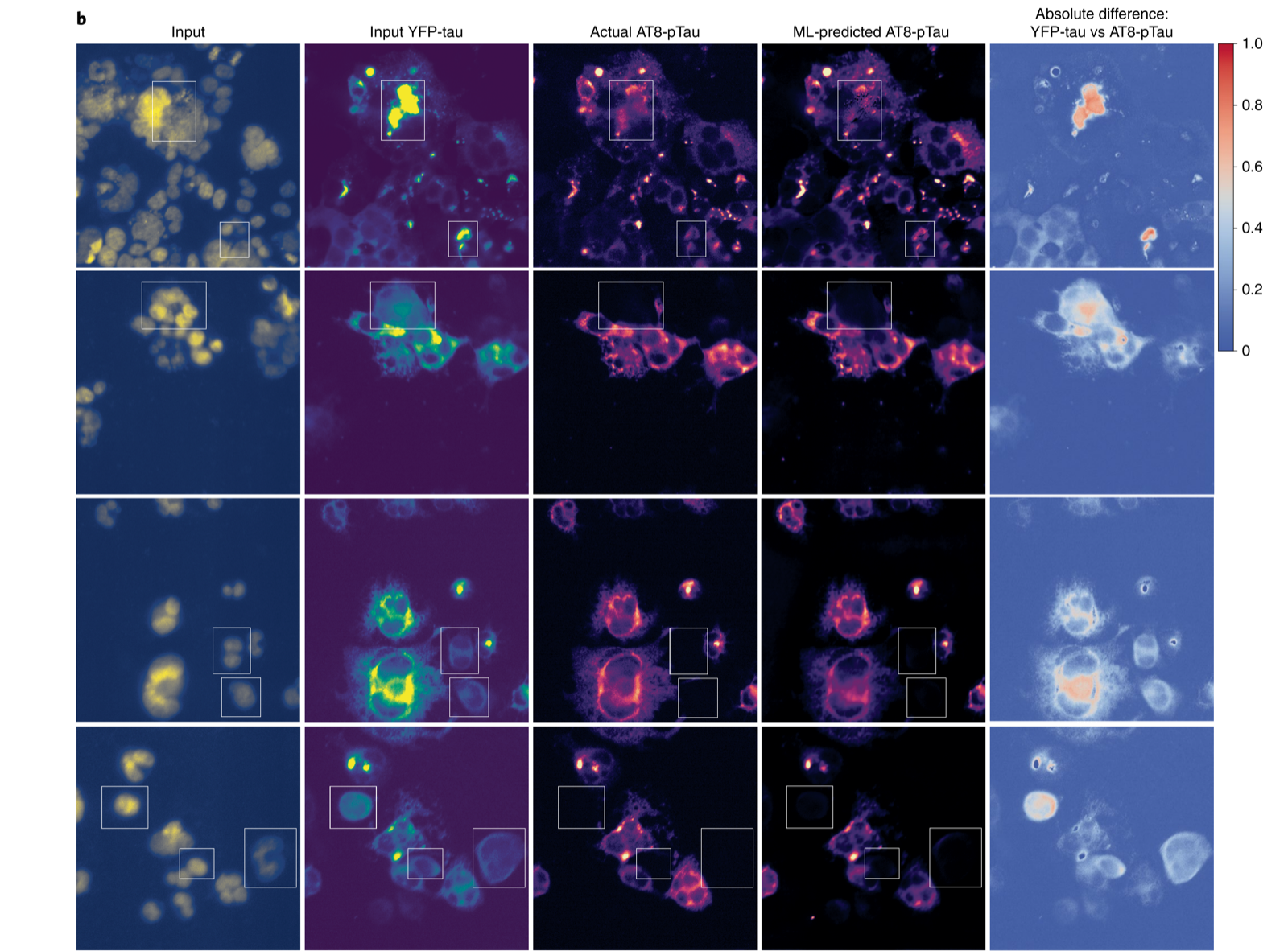 Trans-channel fluorescence learning predicts AT8-pTau from DAPI and YFP-tau channels, from Wong et al., Nature Machine Intelligence 2022